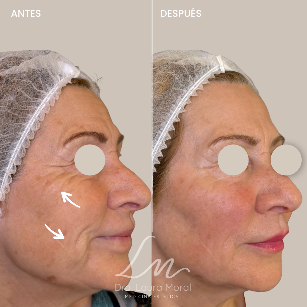 tratamiento simetria malaga antes y despues